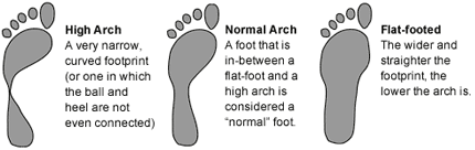 High arch, normal arch and flat arch