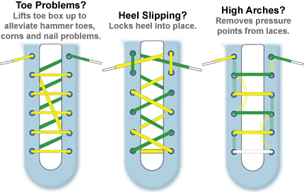 Types of lacing techniques