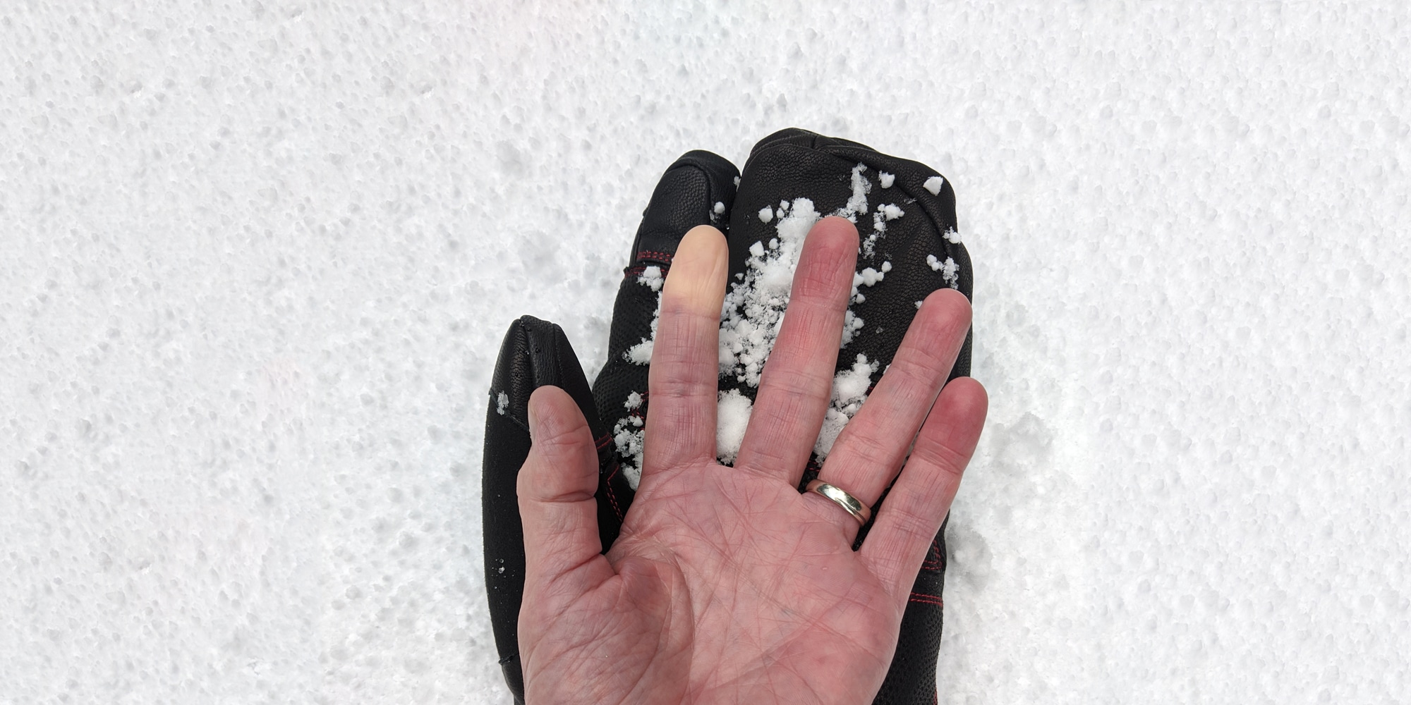 A person's hand showing signs of Raynaud's