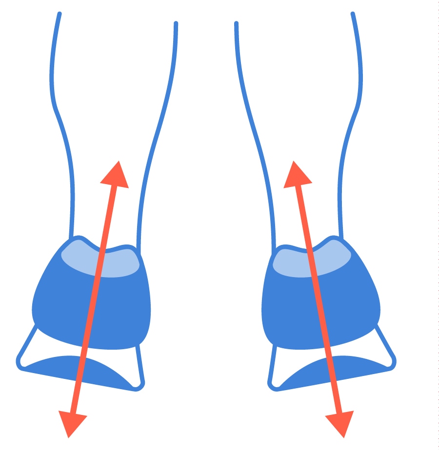 on cloud overpronation