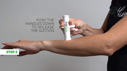 BUG BITE thing Removal Tool 5
